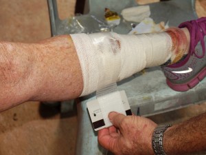 duct-tape-holds-bandage